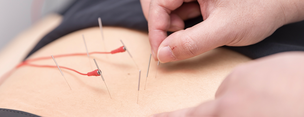 약침치료 이미지