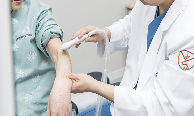 신장분사치료(CRYO)